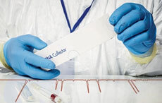 Which DNA Collection Method is Least Invasive?